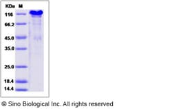 Sino Biological Mouse SPARCL1 / SPARC-like 1 Protein (His Tag) 100ug, Quantity:
