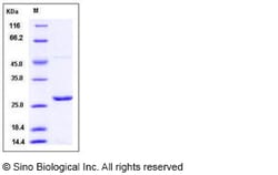 Sino Biological Recombinant Mouse Peroxiredoxin 1 Protein (His Tag), Quantity: