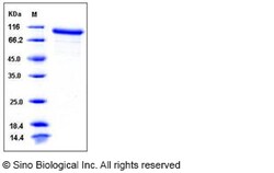 Sino Biological Recombinant Mouse MMP-9 Protein, HPLC-verified 100, Quantity: