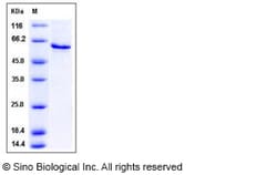 Sino Biological Mouse SerpinB12 Protein (His Tag) 100ug, Quantity: Each