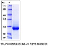 Sino Biological Recombinant Mouse Frizzled-10 Protein (His Tag), Quantity: