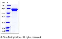 Sino Biological Mouse Fetuin-B / FETUB Protein (His Tag) 100ug, Quantity: