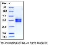 Sino Biological Recombinant Mouse FOLR1 Protein (His Tag) 1, Quantity: