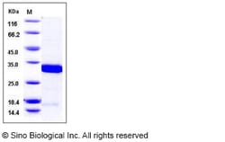 Sino Biological Mouse 14-3-3 sigma / Stratifin / YWHAS Protein 100ug, Quantity: