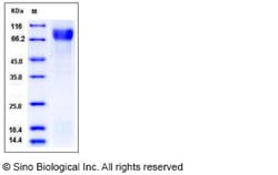 Sino Biological Recombinant Mouse Vitronectin Protein (His Tag), Quantity: