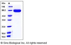Sino Biological Recombinant Mouse EphA2 Protein (His Tag), HPLC-verified,