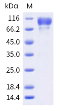 Sino Biological Mouse CD34 Protein 500ug (Sino Biological), Quantity: Each