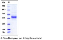 Sino Biological Recombinant Mouse Ephrin A3 Protein (His Tag), Quantity: