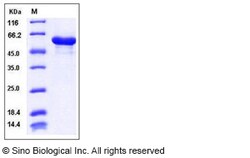 Sino Biological Recombinant Mouse HSP60 Protein (His Tag), Quantity: Each