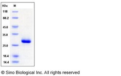 Sino Biological Mouse Ephrin-A5 / EFNA5 Protein (His Tag) 100ug, Quantity: