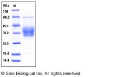 Sino Biological Mouse Ephrin-B2 / EFNB2 Protein (His Tag) 100ug, Quantity: