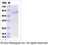Sino Biological Recombinant Mouse METRN Protein (hFc Tag), Quantity: Each