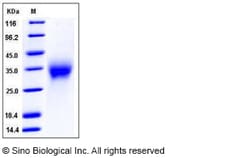 Sino Biological Recombinant Mouse ACVR2A Protein (His Tag), HPLC-verified,