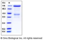 Sino Biological Recombinant Mouse c-MET/HGFR Protein (hFc Tag), HPLC-verified