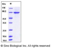 Sino Biological Mouse PLK1 / PLK-1 Protein (His Tag) 50ug, Quantity: Each