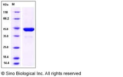 Sino Biological Recombinant Mouse PGK1 Protein (His Tag), Quantity: Each