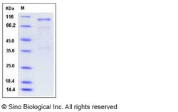 Sino Biological Recombinant Mouse Semaphorin 3A Protein (hFc Tag), Quantity: