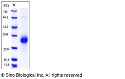 Sino Biological Mouse Adiponectin / Acrp30 / ADIPOQ Protein (His Tag) 100ug,