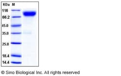 Sino Biological Recombinant Mouse CD200R4 Protein (hFc Tag), Quantity: