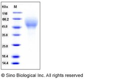 Sino Biological Recombinant Mouse CD200R4 Protein (His Tag), Quantity: