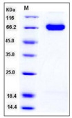 Sino Biological Mouse DLL4 / Delta4 Protein (His Tag) 100ug, Quantity: