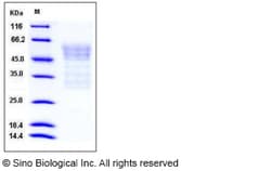 Sino Biological Mouse Syndecan-1 / SDC1 / CD138 Protein (His Tag) 100ug,