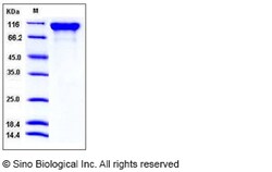 Sino Biological Recombinant Mouse Semaphorin 4D Protein (ECD, His Tag),