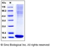 Sino Biological Recombinant Mouse FABP4/A-FABP Protein (His Tag), Quantity: