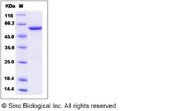 Sino Biological Recombinant Mouse GAD65/GAD2 Protein, Quantity: Each of