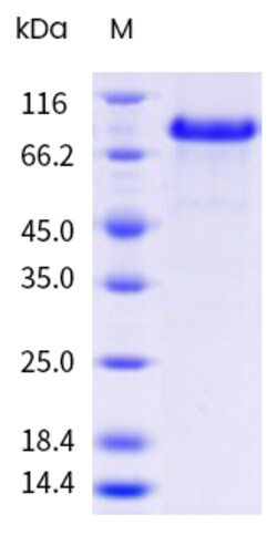 Sino Biological&nbsp;Recombinant Mouse NOTCH1 Protein (His Tag), HPLC-verified 100 µg