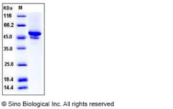 Sino Biological Recombinant Mouse Carbonic Anhydrase IX/CA9 Protein (His