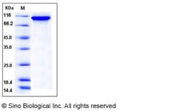 Sino Biological Recombinant Mouse Autotaxin/ENPP-2 Protein (His Tag), Quantity: