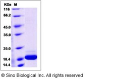 Sino Biological Mouse IFNA14 / Interferon alpha-14 Protein (His Tag) 100ug,