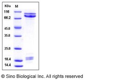 Sino Biological Recombinant Mouse E-Cadherin Protein (His Tag), Quantity: