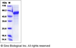 Sino Biological Mouse Noggin / NOG Protein (Fc Tag) 1mg, Quantity: Each