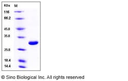 Sino Biological Recombinant Mouse UCHL1 Protein (His Tag), Quantity: Each