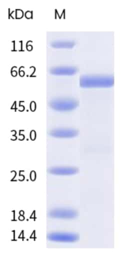 Sino Biological&nbsp;Recombinant Mouse 14-3-3 epsilon Protein (GST Tag), Biotinylated 100