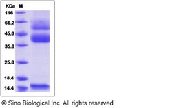 Sino Biological Mouse Latent TGF-beta 1 / TGFB1 Protein (His Tag), Biotinylated