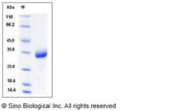 Sino Biological Recombinant Mouse CHODL Protein (His Tag), Quantity: Each