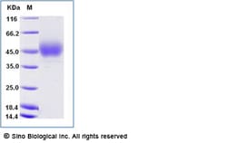 Sino Biological Recombinant Mouse NKp46/NCR1 Protein (ECD, His Tag), HPLC-verified