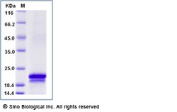Sino Biological Recombinant Mouse CLEC3A Protein (His Tag), Quantity: Each