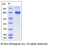 Sino Biological Recombinant Mouse IFNGR1 Protein (hFc Tag), Quantity: Each