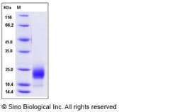 Sino Biological Recombinant Mouse CD302 Protein (His Tag), Quantity: Each