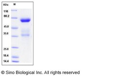 Sino Biological Recombinant Mouse CLEC10A/CD301 Protein (hFc Tag), Quantity: