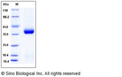 Sino Biological Recombinant Mouse CLEC10A/CD301 Protein (His Tag), Quantity: