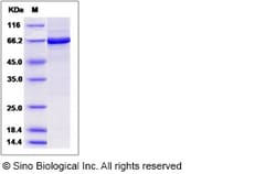 Sino Biological Recombinant Mouse Brk Protein (His & GST Tag), Quantity: