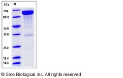 Sino Biological Recombinant Mouse CD6 Protein (hFc Tag), Quantity: Each