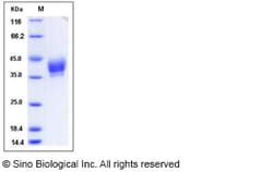 Sino Biological Recombinant Mouse Siglec-3/CD33 Protein (His Tag), HPLC-verified,