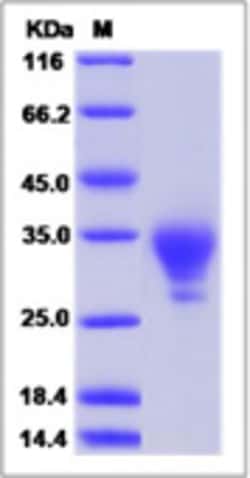 Sino Biological Mouse WAP5 / WFDC2 / HE4 Protein (His Tag) 50ug, Quantity: