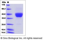 Sino Biological Recombinant Mouse CD52 Protein (hFc Tag), Quantity: Each